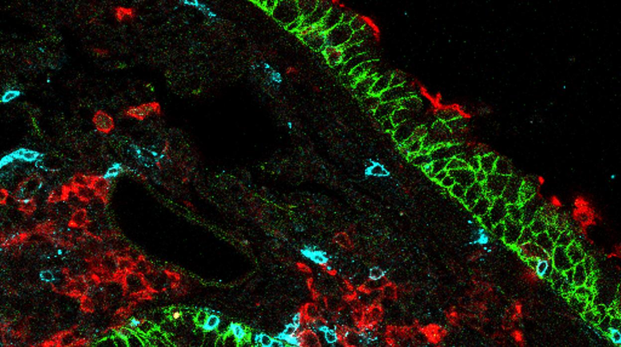 Células T asesinas CD8 específicas de pulmón (azul) en tejido pulmonar (verde) rodeadas de células dendríticas pulmonares (rojo)