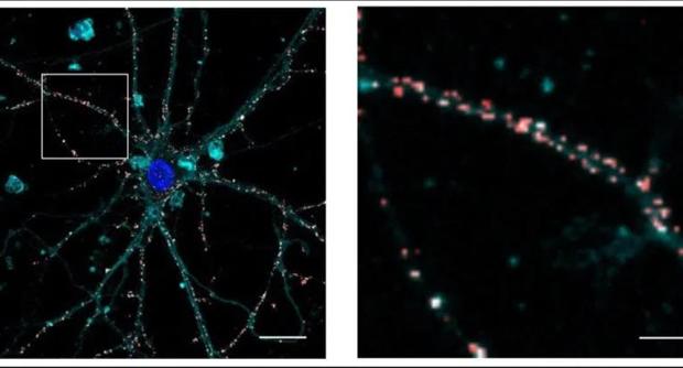 Devuelven la vista durante 8 meses a ratas ciegas gracias a una retina artificial que se inyecta en el ojo