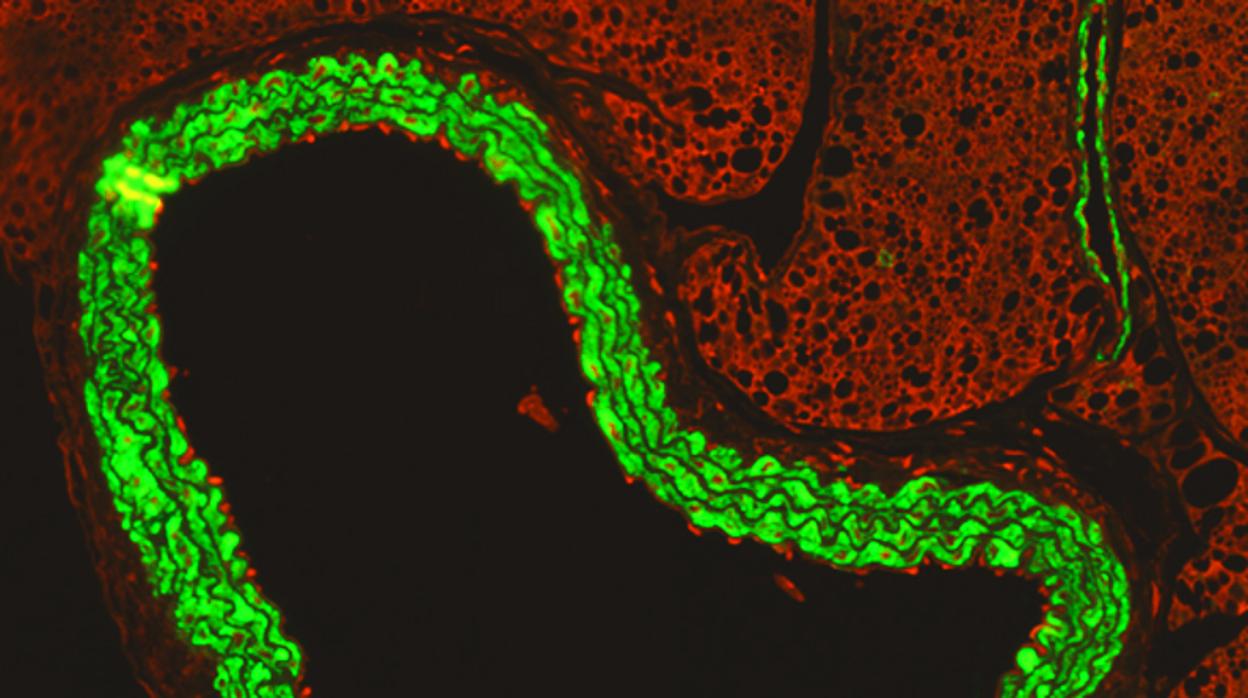 Una imagen de microscopía de inmunofluorescencia muestra cómo las células inmunitarias activadas (rojo) se "adhieren" al interior de la aorta (verde) durante la infección por gripe durante el embarazo.