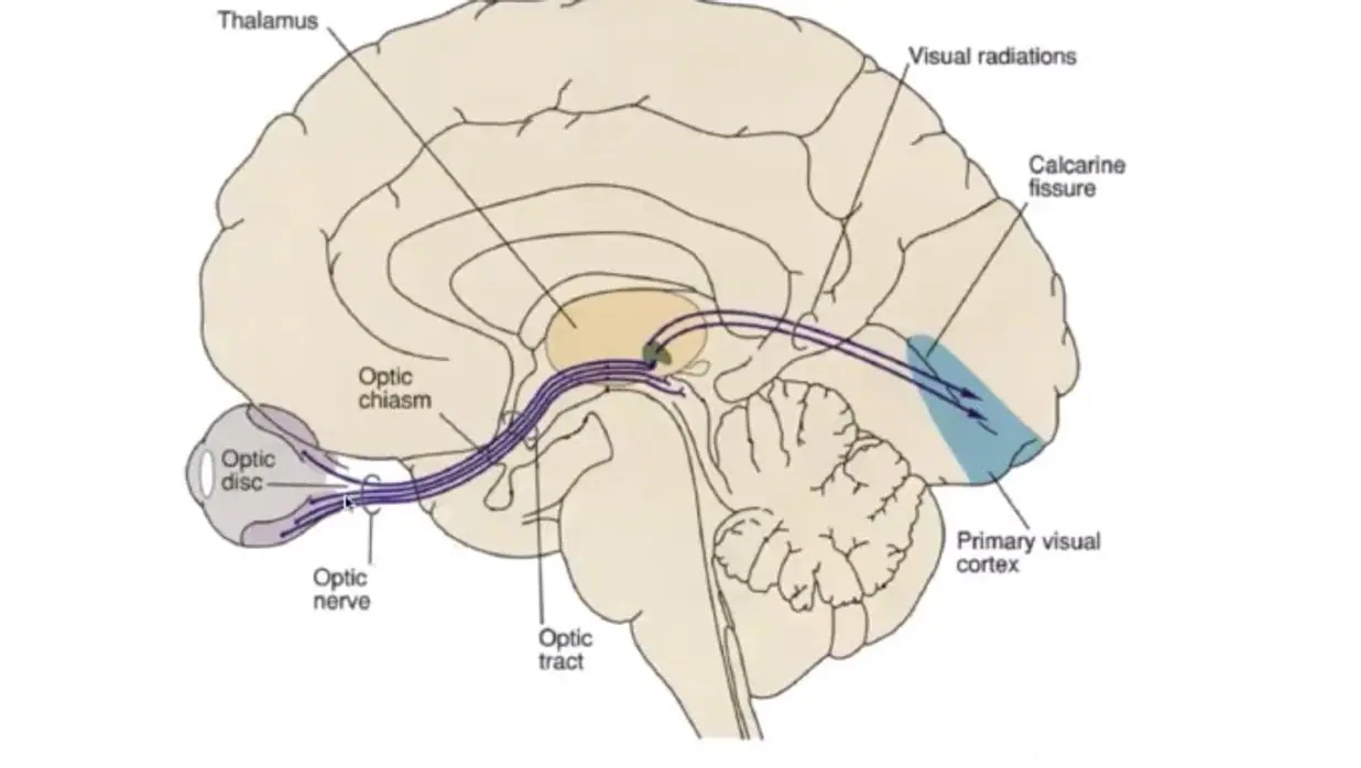 Implante cerebral