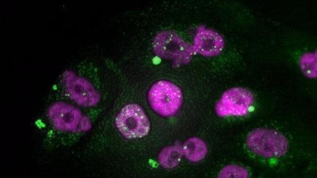 Fármaco antitumoral obtiene resultados prometedores contra el neuroblastoma