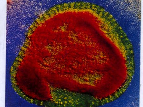 Primera foto del Virus de la Gripe en los años 50