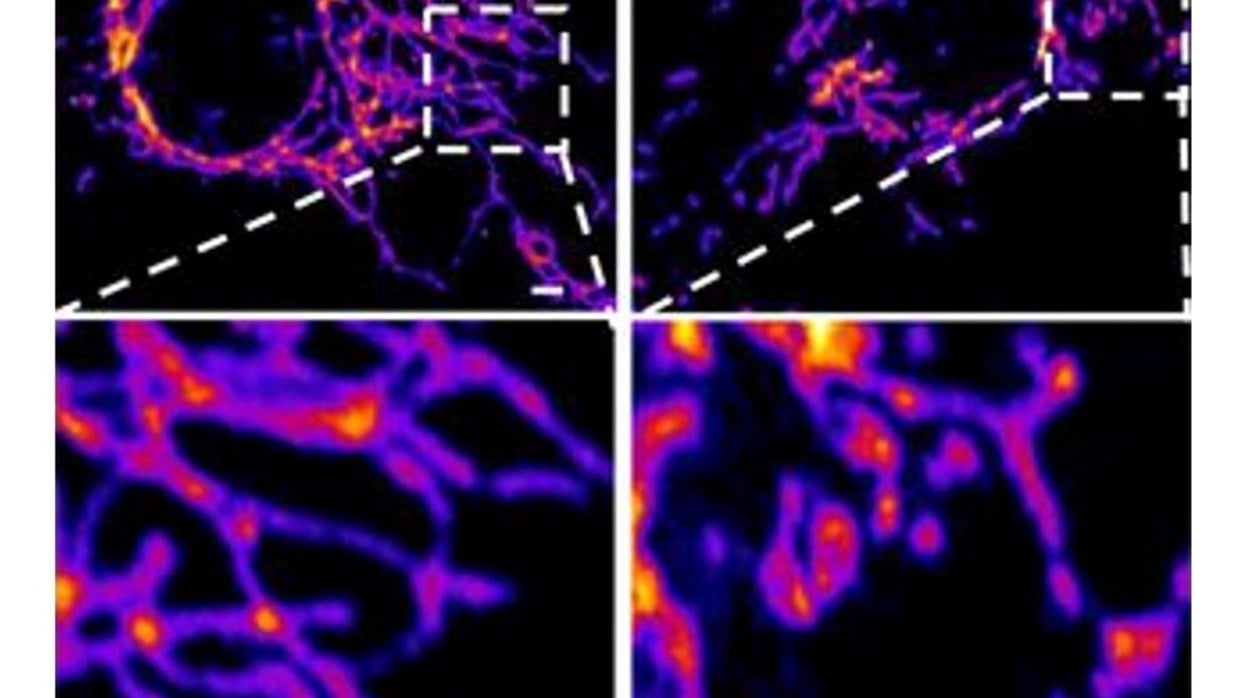 Imágenes de las células de control del endotelio vascular (izquierda) y las células tratadas con la proteína espiga del SARS-CoV-2 (derecha) muestran que la proteína espiga provoca un aumento de la fragmentación mitocondrial en las células vasculares