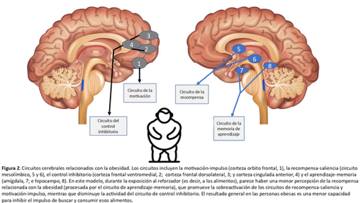 Obesidad y adicción a la comida: un problema emergente de salud pública