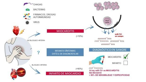 Una gota de sangre para identificar un ‘falso infarto’