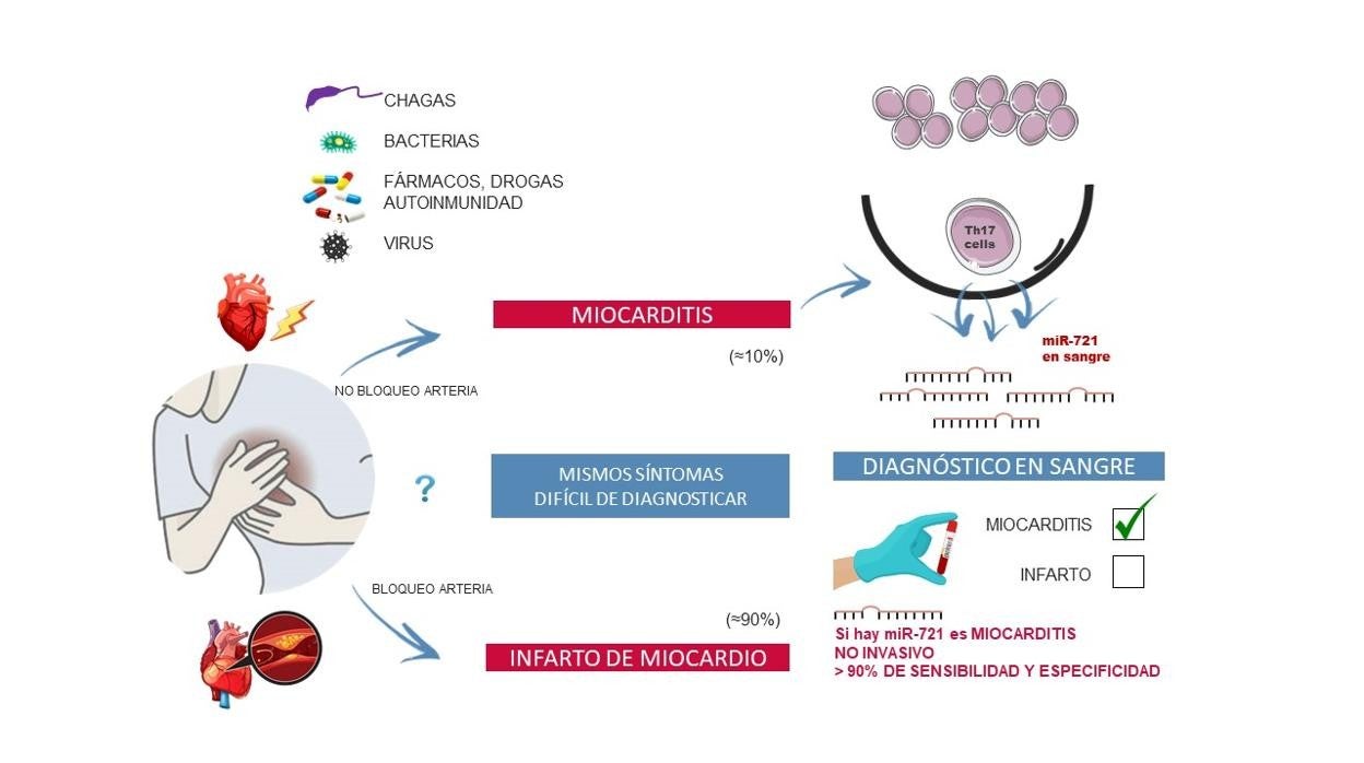 Una gota de sangre para identificar un ‘falso infarto’