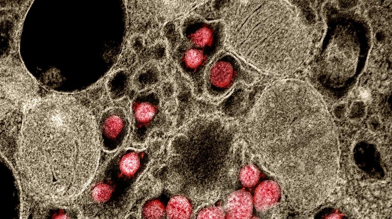 Partículas de SARS-CoV-2