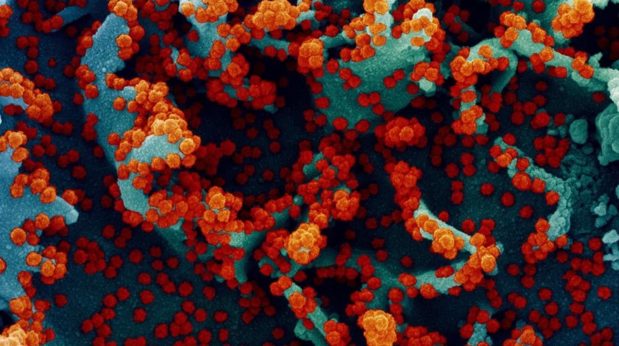 Micrografía electrónica de barrido coloreada de una célula humana muy infectada con partículas del virus SARS-CoV-2 (rojo).