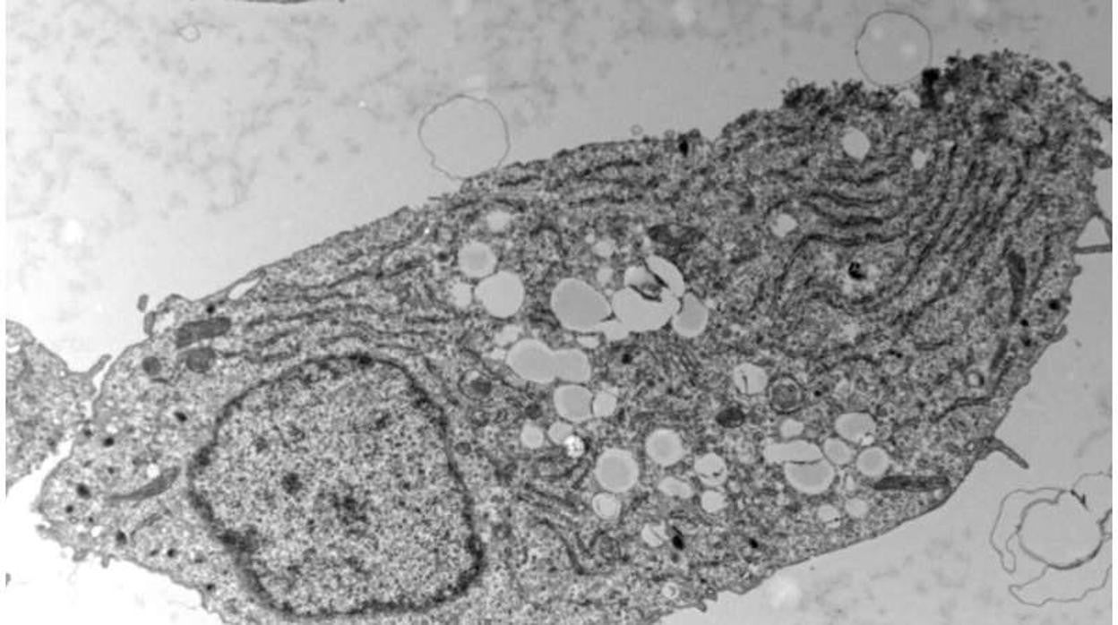 Célula beta pancreática bajo microscopía electrónica. Los círculos blancos visibles en el centro de la celda corresponden a gotas de almacenamiento de grasa