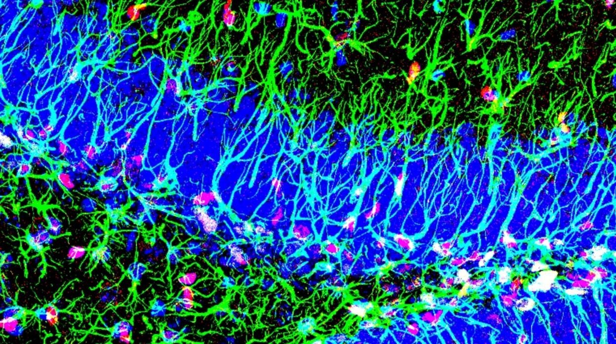 Muestra microscópica del hipocampo con presencia de células madre y la proteína Sox6.