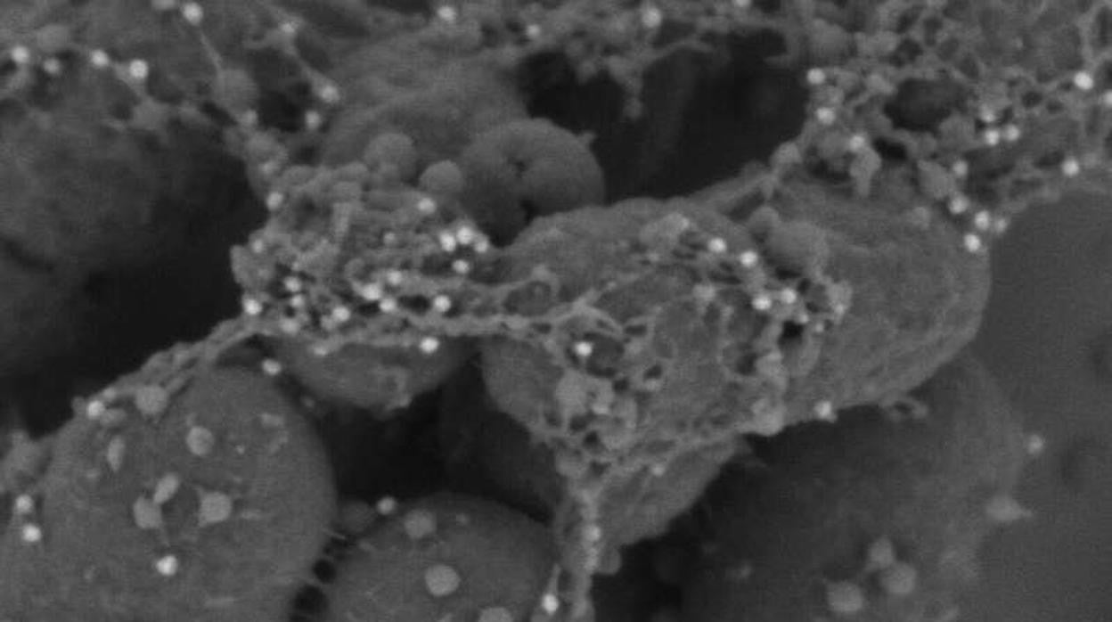 Inmunotinción de oro coloidal (perlas blancas) para la proteína SCPPPQ1 visualizada mediante microscopía electrónica de barrido, que muestra la interacción íntima de la proteína con la bacteria P. gingivalis.