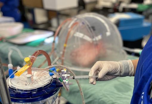 Órganos de tipo de sangre universal