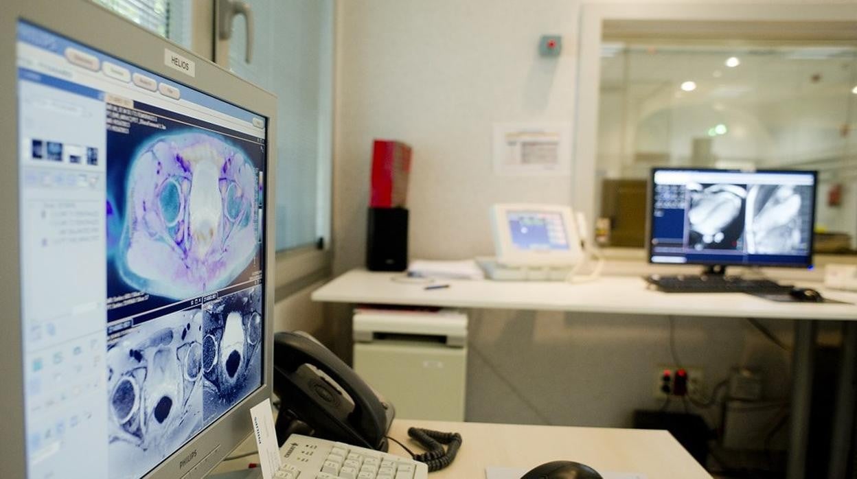 El riesgo de infarto en las personas con VIH es más del doble