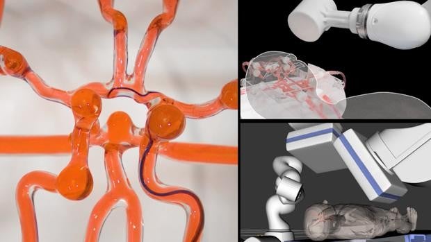 Desarrollan un joystick que podría permitir a los cirujanos operar rápido y a distancia un ictus