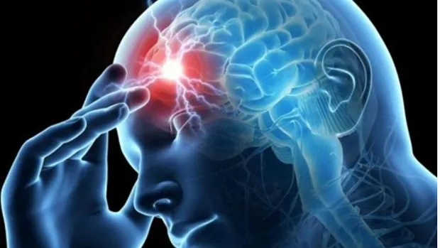 ¿Cefalea o migraña? Aprende a diferenciar tu dolor de cabeza