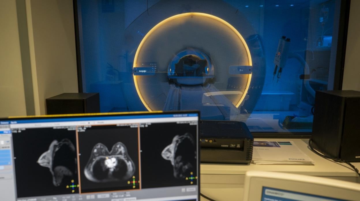 Diagnóstico de cáncer de mama