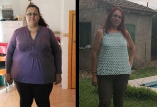 Cambio experimentado por María José Garrido, que pesaba 165 kilos antes de la operación