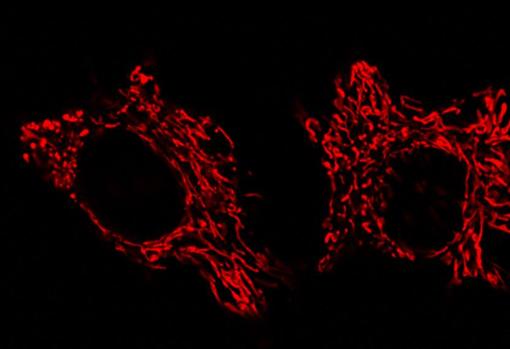 Imagen obtenida con microscopio confocal sobre células HeLa donde las mitocondrias se han marcado con anticuerpo fluorescente rojo