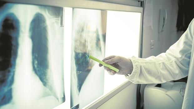 Condenan a un hospital de Sevilla a pagar 350.000 euros por confundir una bronquitis con un cáncer