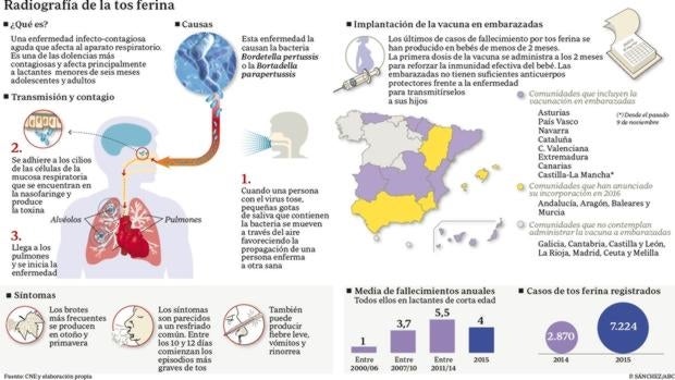 Sanidad estudia la petición de los pediatras de retrasar la vacuna de recuerdo de la tosferina