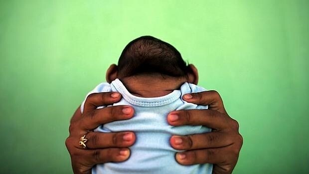 Un bebé de cuatro meses con mcirocefalia, en Recife, Brasil
