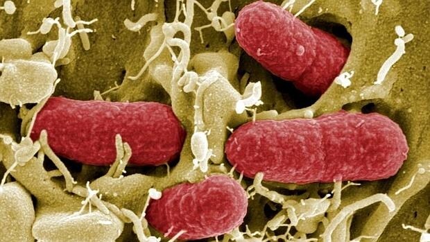 La bacteria E.coli
