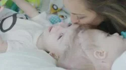 Captura de un vídeo colgado por los padres donde los niños aún estaban unidos, antes de la operación