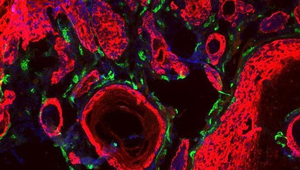 Fotografía facilitada De un tumor en un ratón donde se muestran las células tumorales (rojo) y los vasos sanguíneos que le proporcionan nutrientes (en verde)