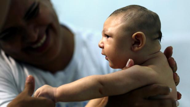 Una sola mutación genética del zika fue la responsable de causar microcefalia en los fetos