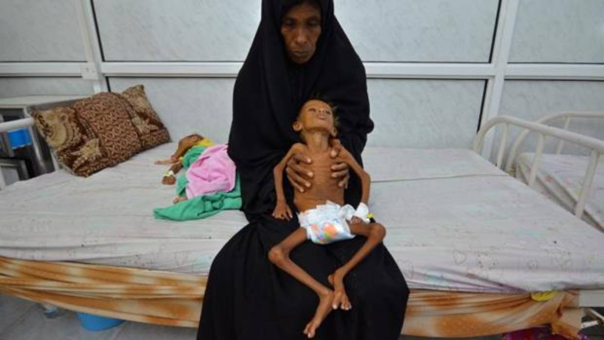 Una madre con su hijo en la unidad de cuidados intensivos por malnutrición en Yemen