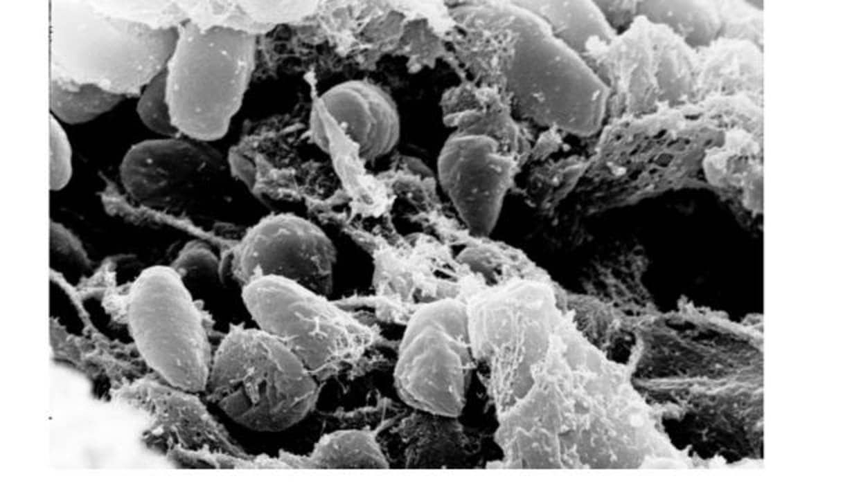 Fotografía microscópica mostrando la bacteria Yersinia pestis (causante de la peste) en el estómago de la pulga (vector de la infección)