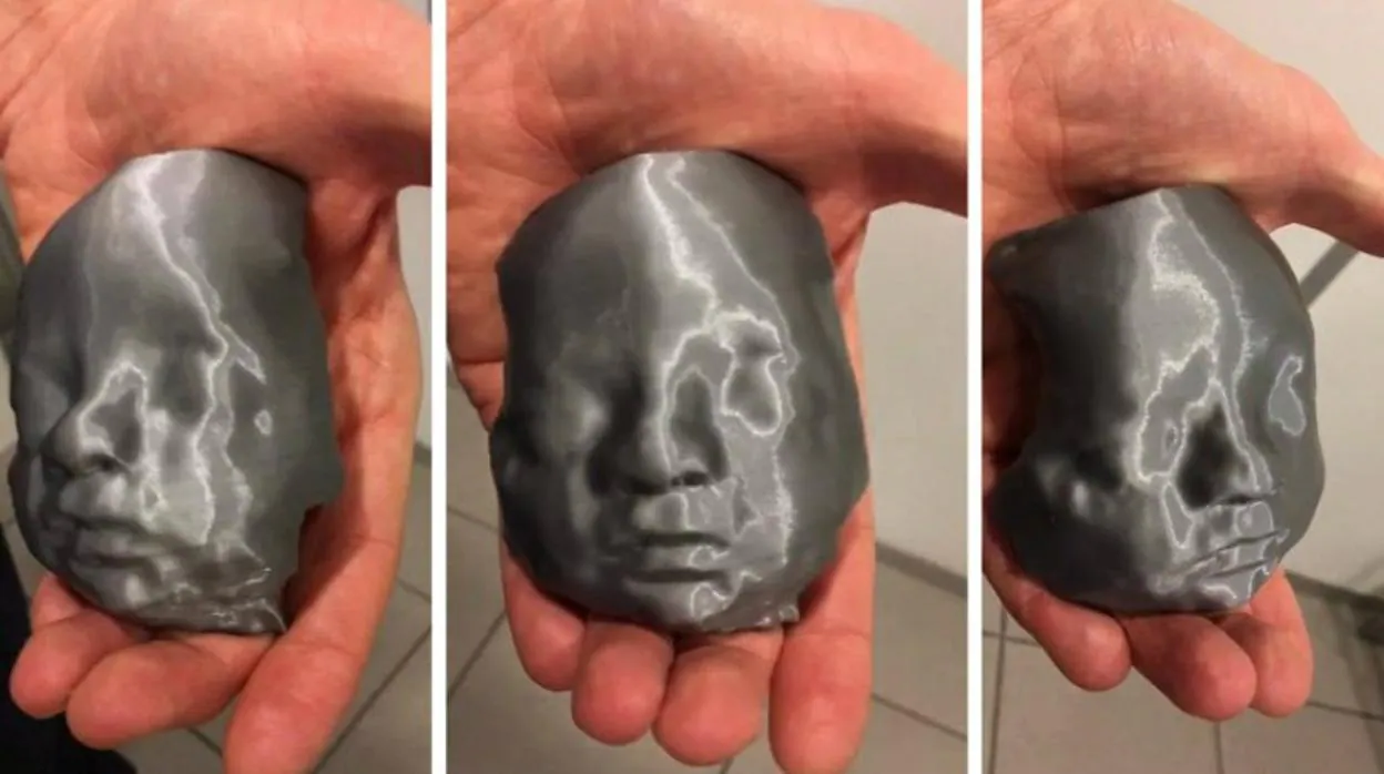 La réplica 3D creada por los médicos