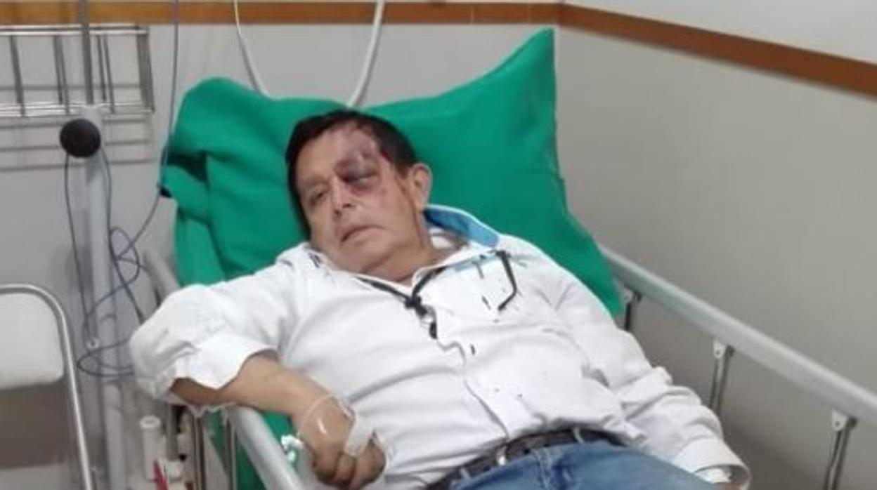 Un hombre de 62 años, a punto de perder el ojo izquierdo tras una brutal paliza en Perú