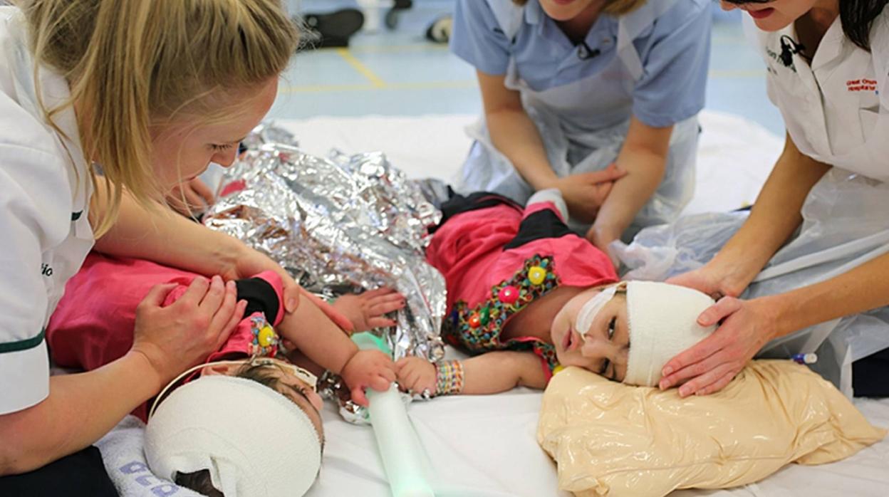 Las dos niñas de Pakistán, en una foto del hospital