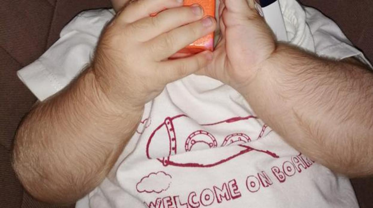 Imagen de uno de los bebés afectados por el crecepelo