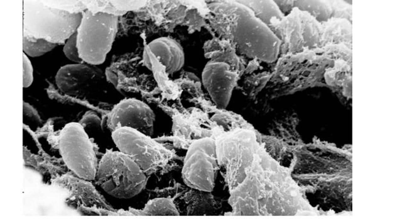 Fotografía microscópica mostrando la bacteria Yersinia pestis (causante de la peste) en el estómago de la pulga (vector de la infección)