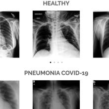 Las tres buenas noticias de hoy sobre el coronavirus