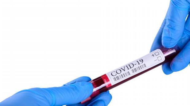¿En qué se diferencia el nuevo test de coronavirus del CSIC de los que ya hay en el mercado?
