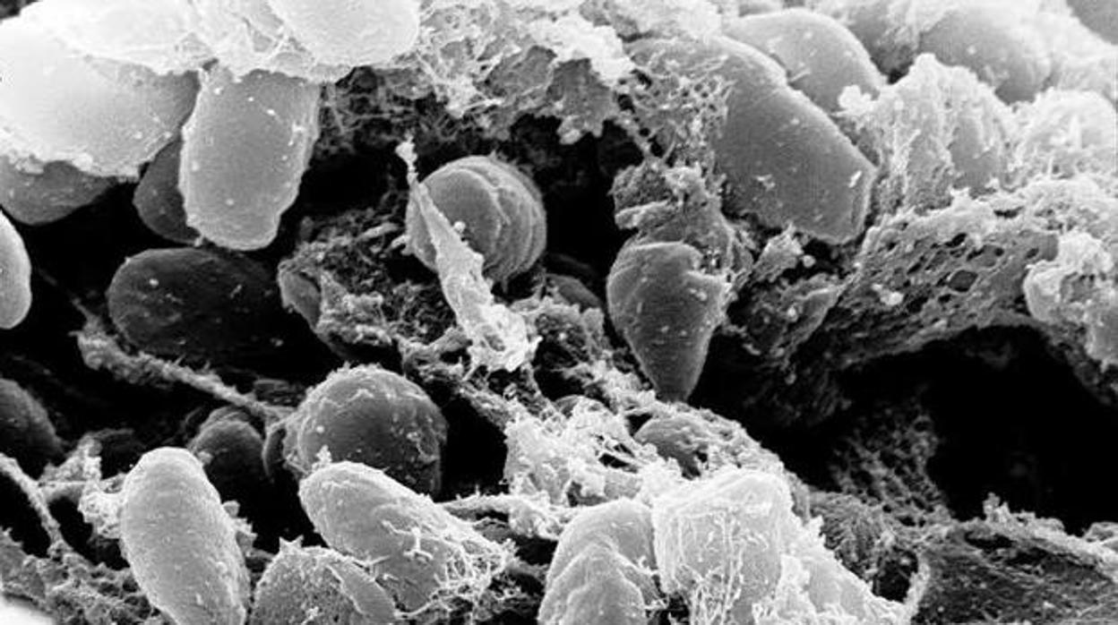 La peste bubónica es una enfermedad causada por la bacteria Yersinia pestis