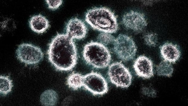 El CSIC desarrolla un test de anticuerpos del coronavirus más sensible y fiable al 99%