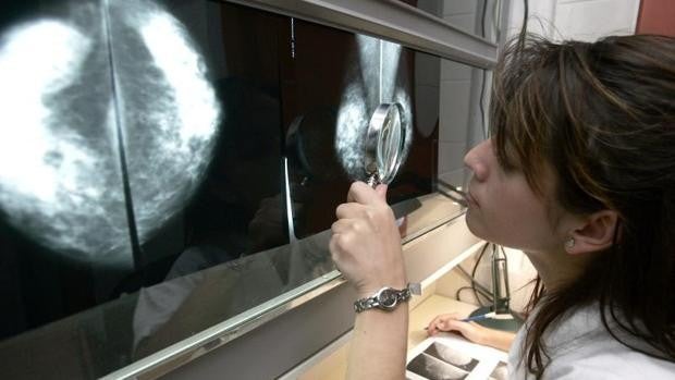 Sanidad veta un fármaco prometedor para mujeres con un cáncer de mama agresivo