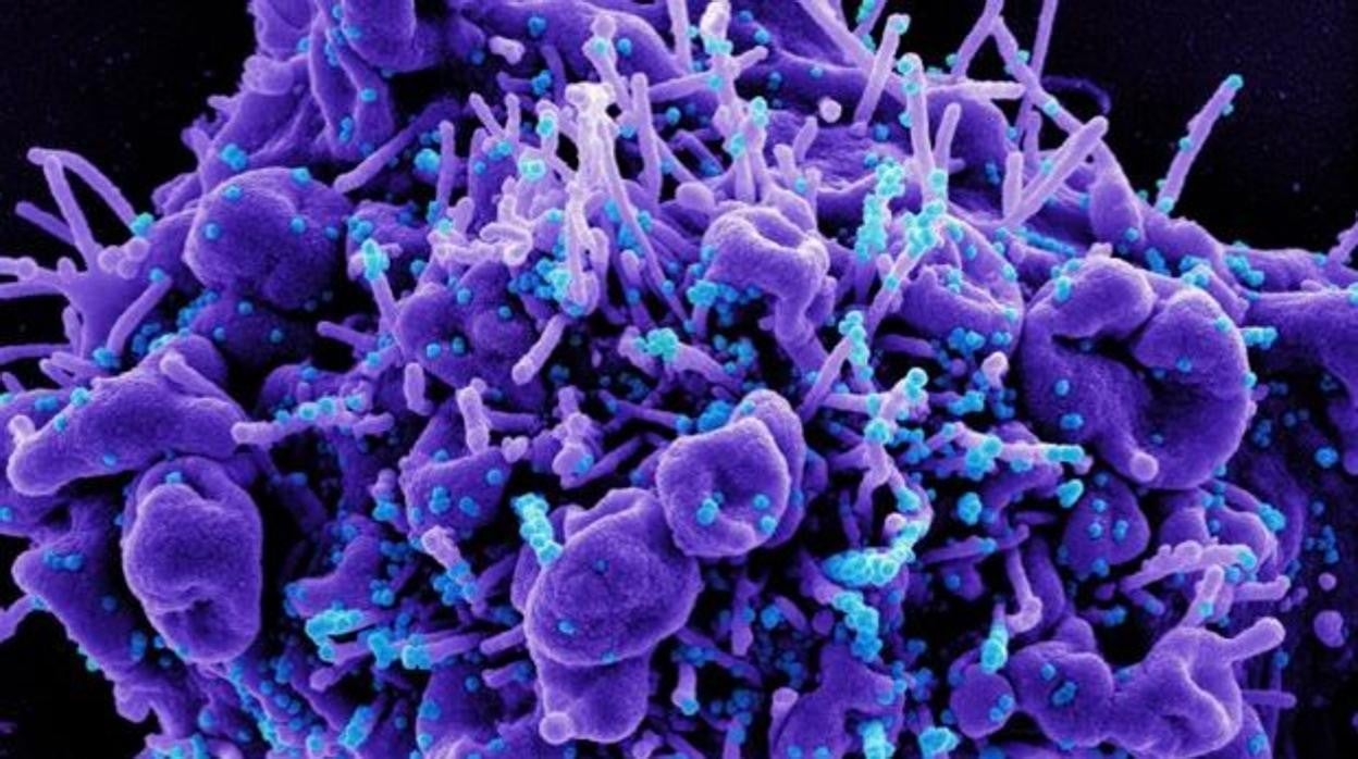 Micrografía electrónica de barrido coloreada de una célula apoptótica (púrpura) infectada con partículas del virus SARS-COV-2 (azul)