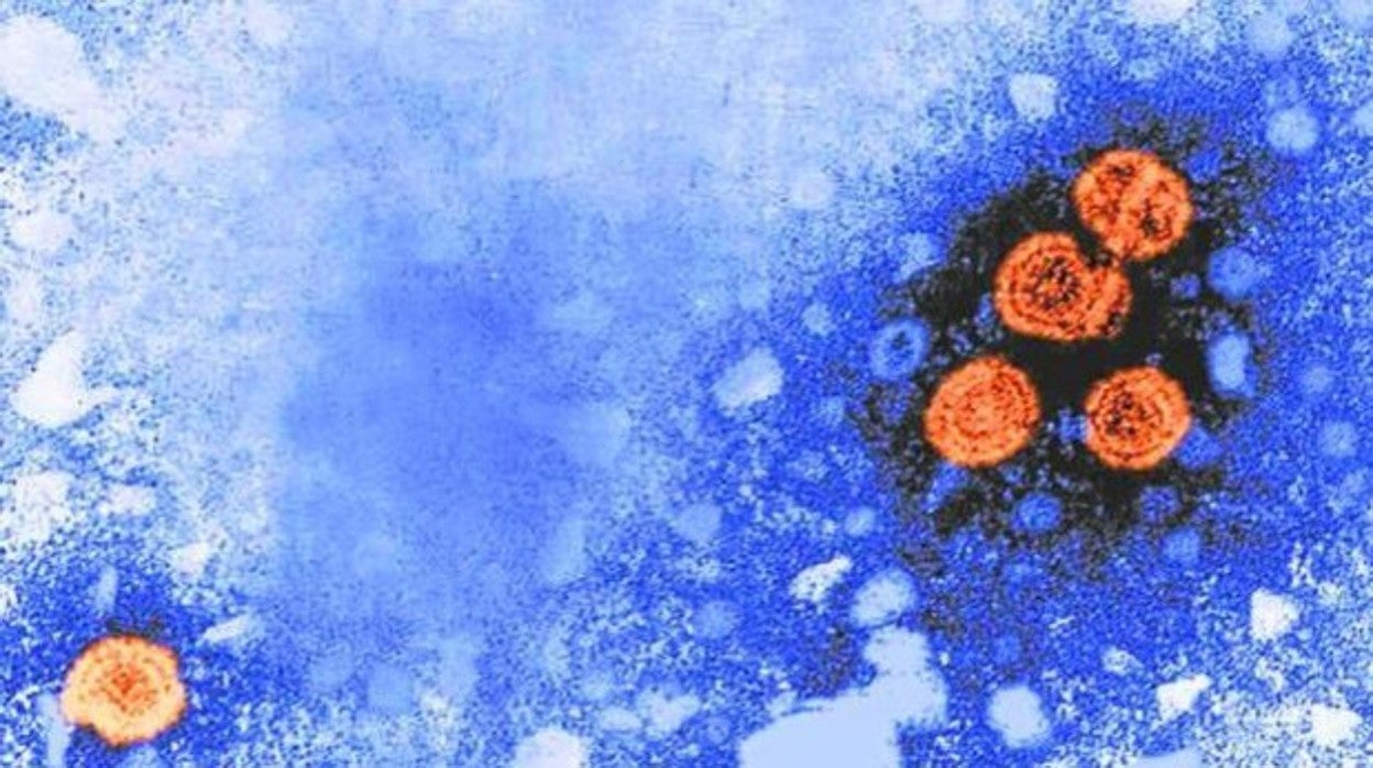 Imagen al microscopio del virus que causa la hepatitis