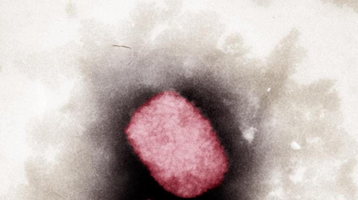 Imagen al microscopio del virus que causa la viruela del mono