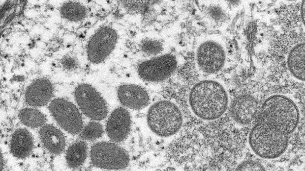 La OMS descarta que el virus de la viruela del mono haya mutado