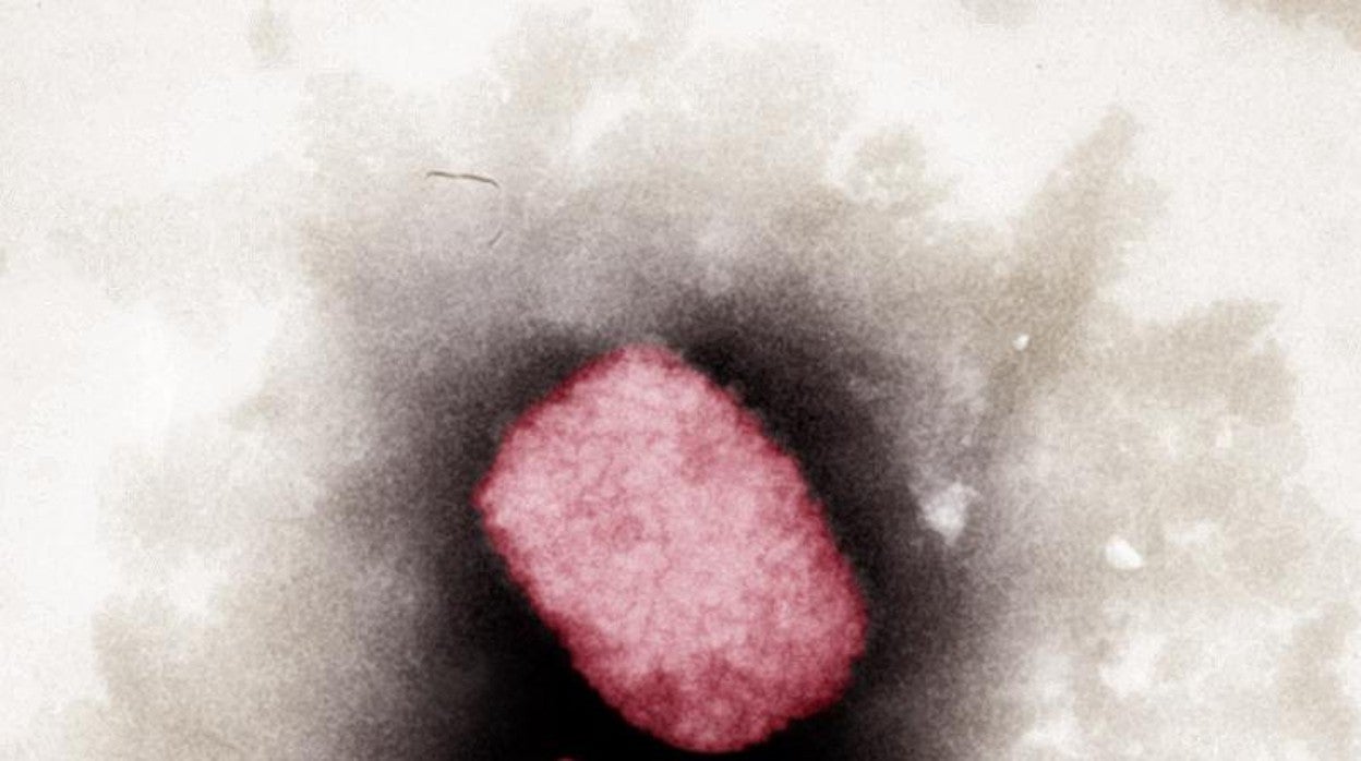 El virus visto a color desde un microscopio