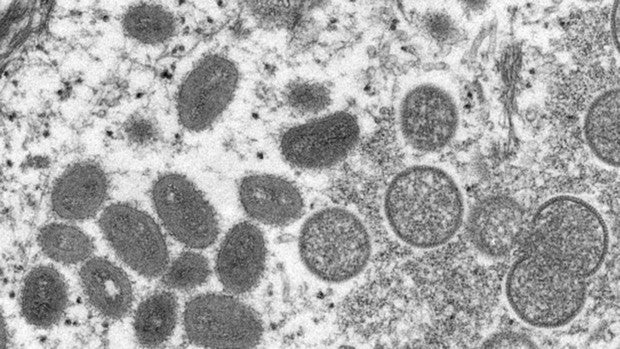 Una imagen microscópica electrónica muestra partículas maduras del virus de la viruela del mono