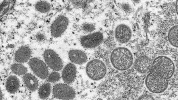 El virus visto desde un microscopio