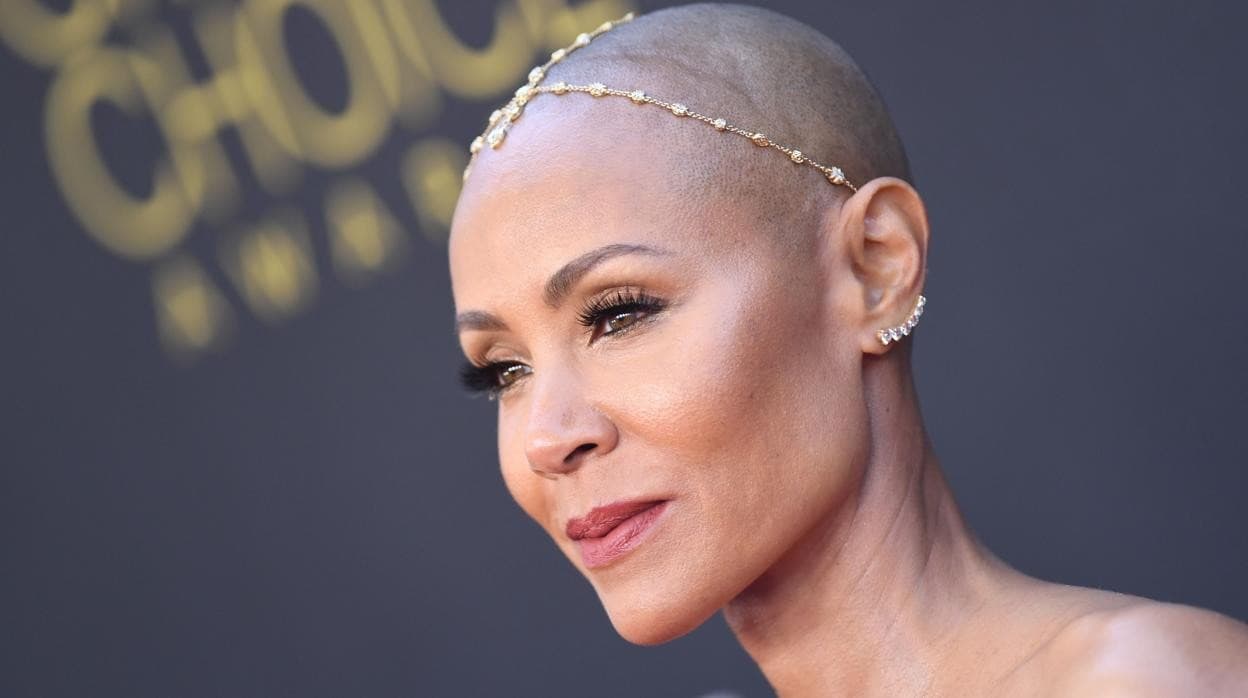 La mujer de Will Smith, Jada Pinkett, que sufre alopecia areata