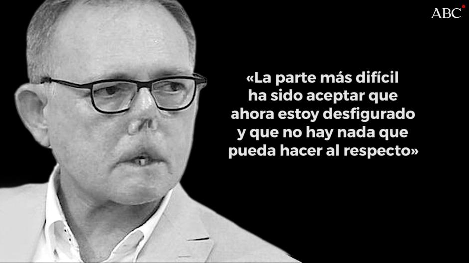 Amputado por el arañazo de su perro